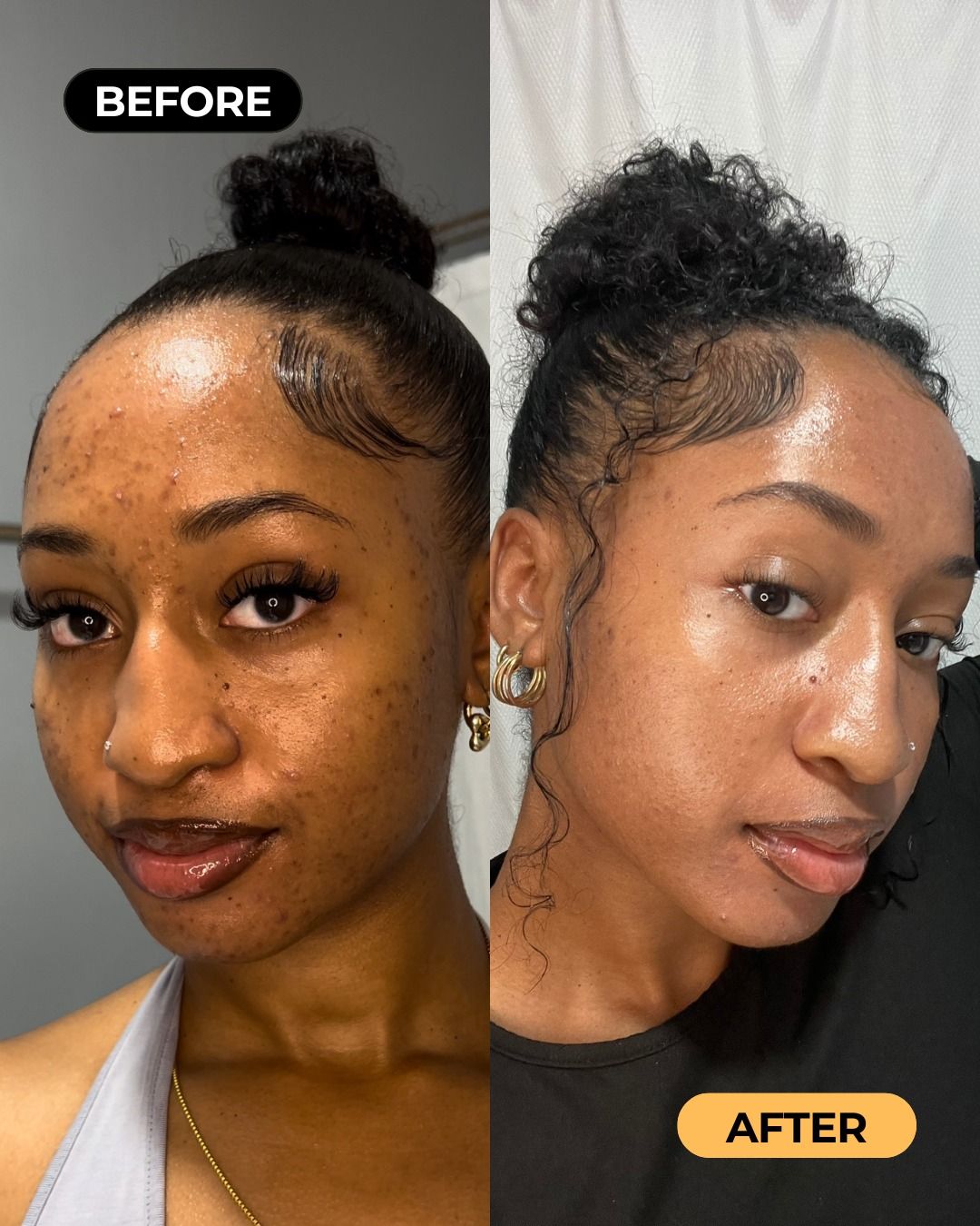 Ngozi E. before and after