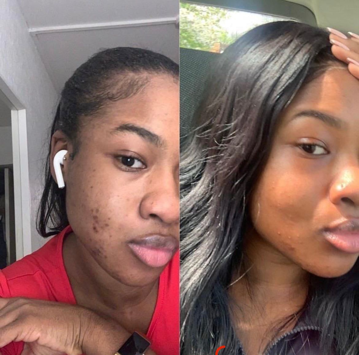 Fatimah K. before and after