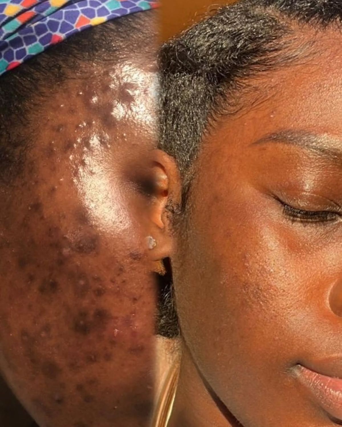 Chisom N. before and after